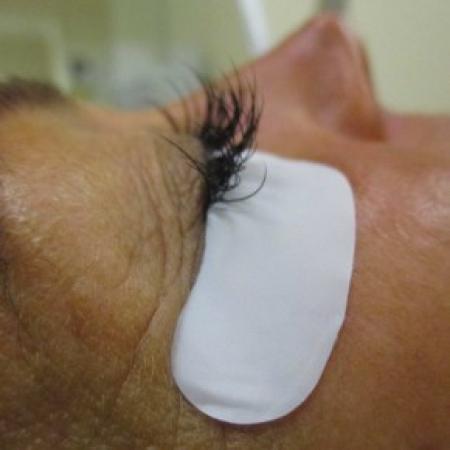 After image 1 Case #82796 - Eyelash Extension