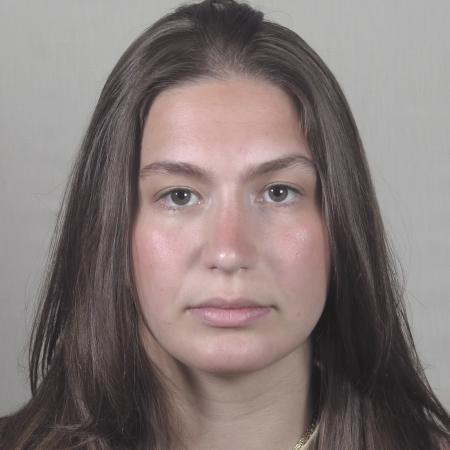 After image 1 Case #124566 - Rhinoplasty with chin augmentation Patient #1416 