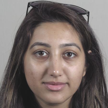 After image 1 Case #124571 - Rhinoplasty Patient #1449