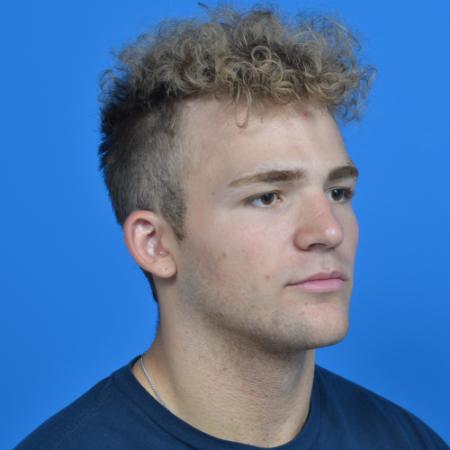 Before image 2 Case #126566 - Otoplasty 19 year old