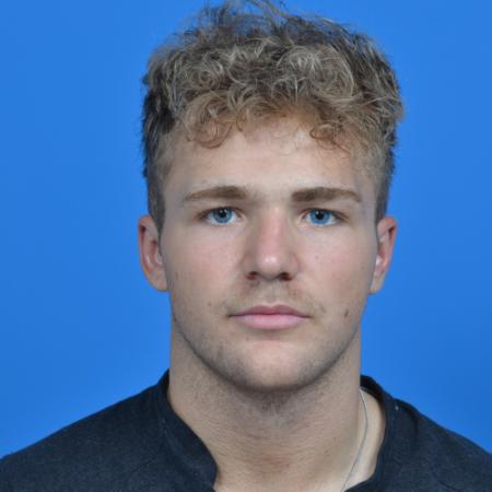 After image 1 Case #126566 - Otoplasty 19 year old