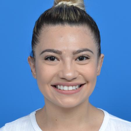 After image 1 Case #126176 - otoplasty and earlobe repair