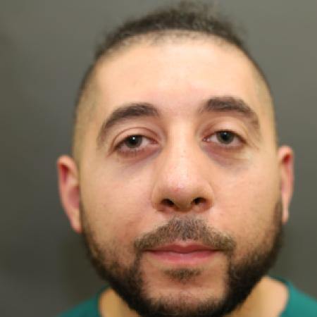 After image 1 Case #126831 - Rhinoplasty