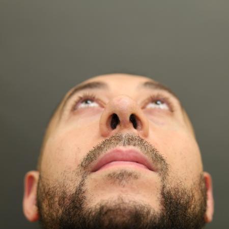 After image 3 Case #126831 - Rhinoplasty