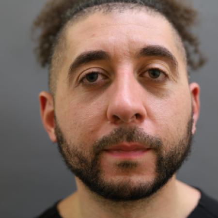 Before image 1 Case #126831 - Rhinoplasty