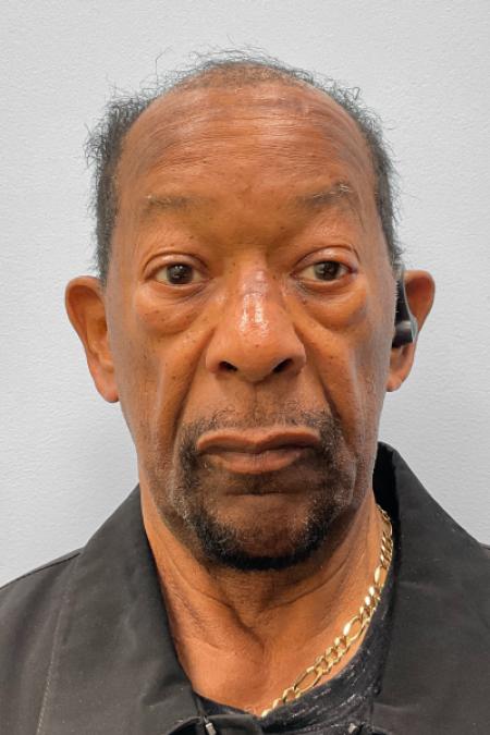 Before image 1 Case #134471 - Lower Blepharoplasty